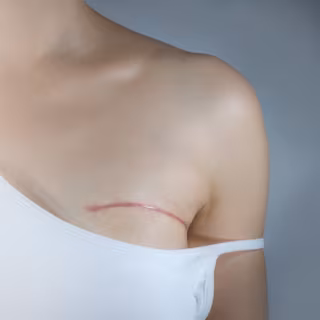 Reembolso de Productos de Apoyo: Guía Completa