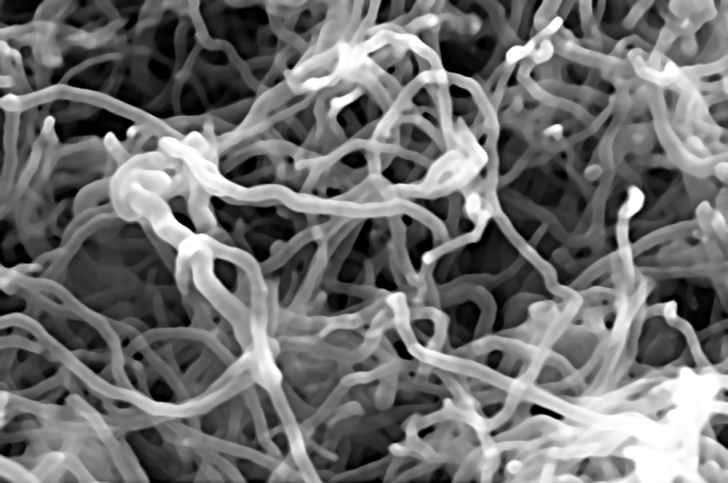 Demostrado Riesgo de cáncer por nanotubos de carbono