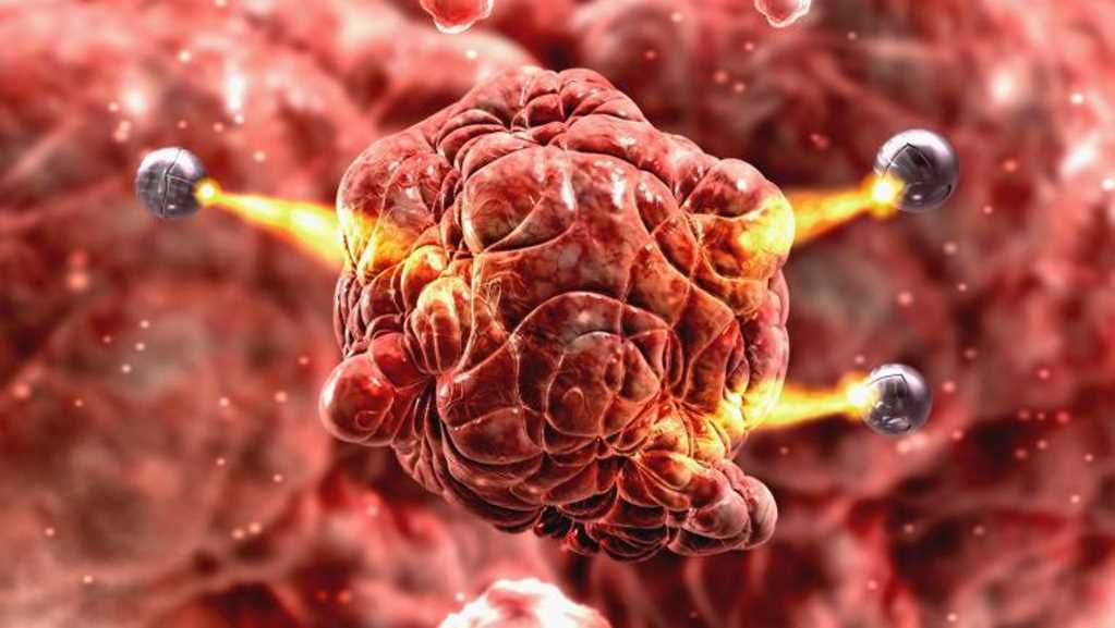 ¿Puede la nanotecnología ayudar a tratar el Alzheimer?